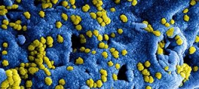 Зураб Ачба: Наша страна никак не борется с коронавирусом